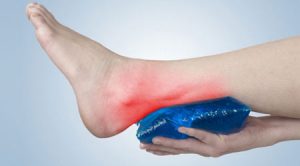 التهاب تاندون آشیل